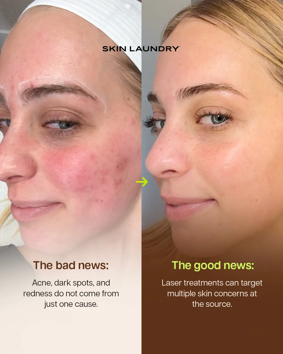 Skin Laundry creative