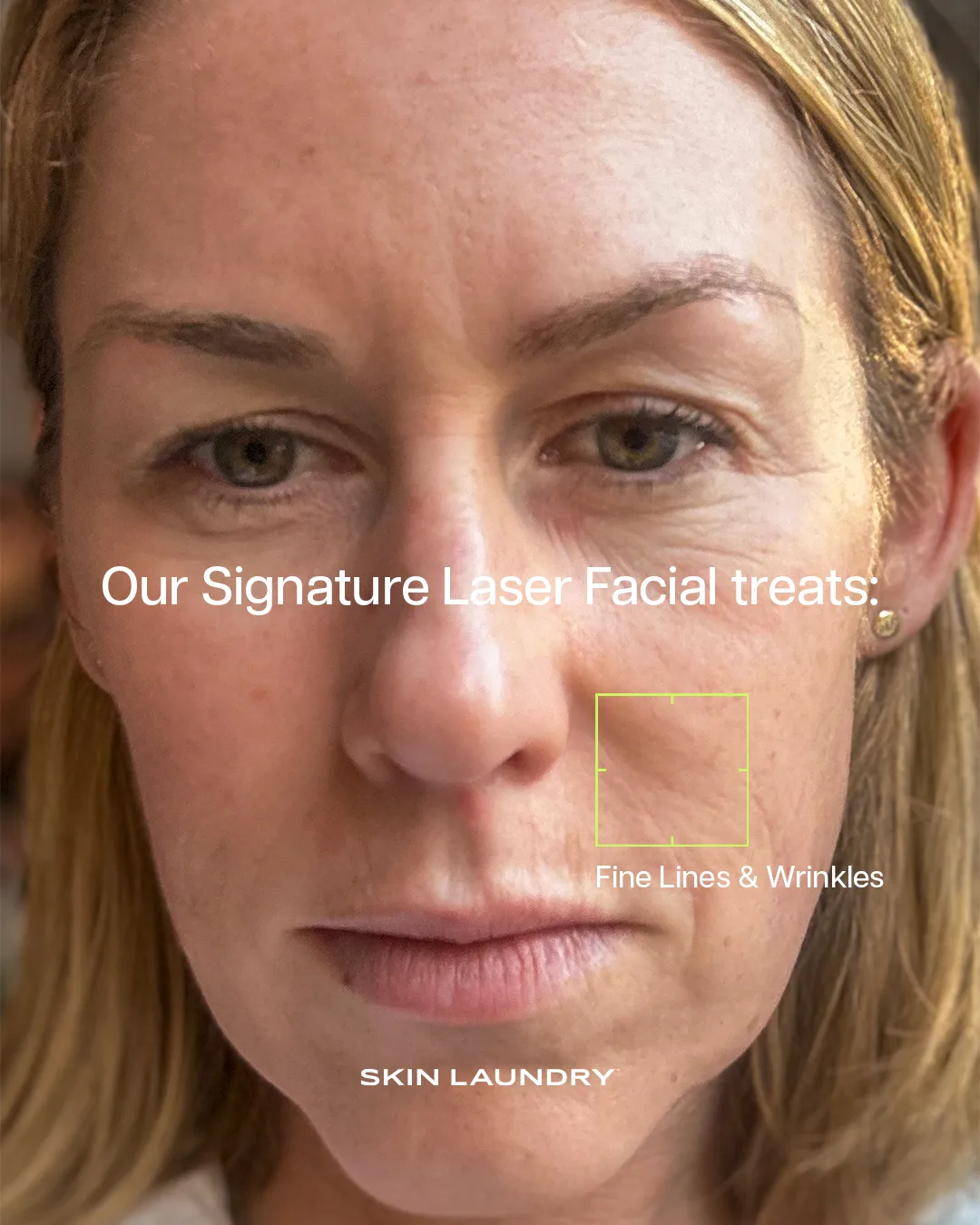 Skin Laundry creative
