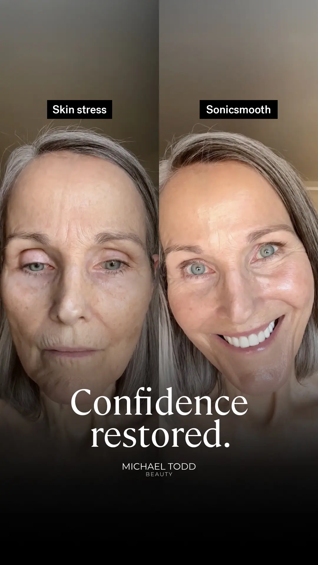 Michael Todd Beauty Statics Beauty 10