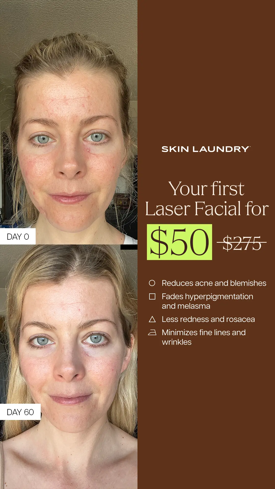 Skin Laundry Statics Beauty 3
